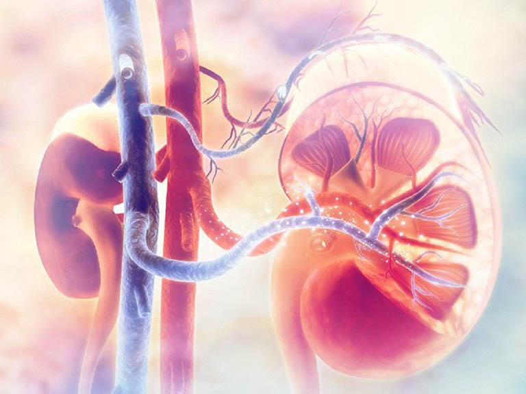 hieu-dung-ve-tinh-trang-benh-than-u-nuoc